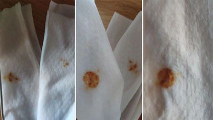 "Bloody" Wet Wipes